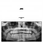 Jack Van Cleaf - JVC