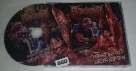 Buttholectomy-Maggot Infested Carcass Eruption- BM202 -CD-FLAC-2025-86D