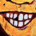 Sean Trelford - ulcer