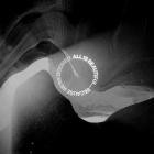 We Came As Romans - ALL IS BEAUTIFUL -  BECAUSE WE'RE DOOMED
