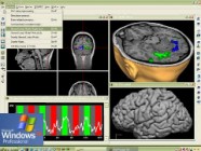 BrainVoyager QX v2.0.7