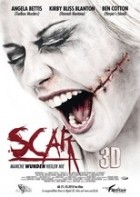 Scar 3D